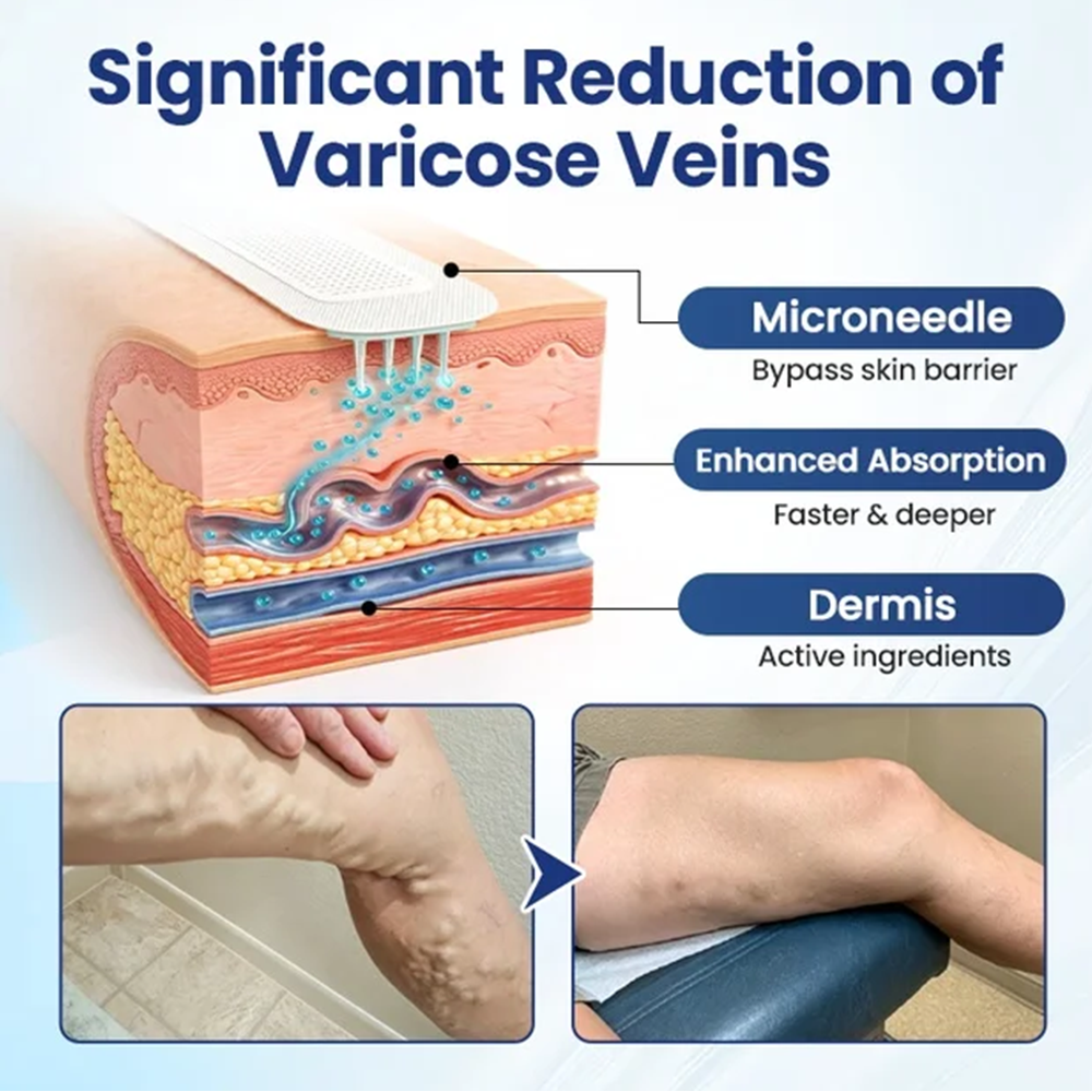 Deep Vein Repair Microneedle Patch🔥🔥