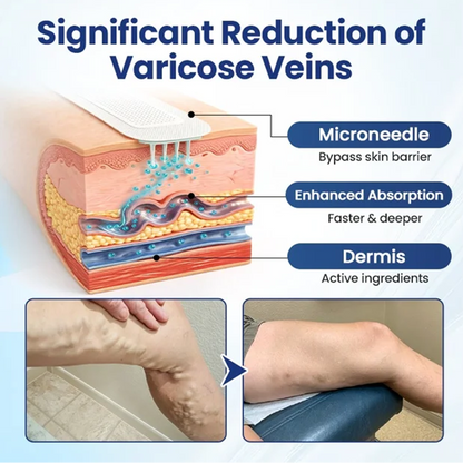 Deep Vein Repair Microneedle Patch🔥🔥