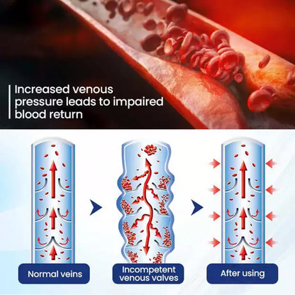 Deep Vein Repair Microneedle Patch🔥🔥