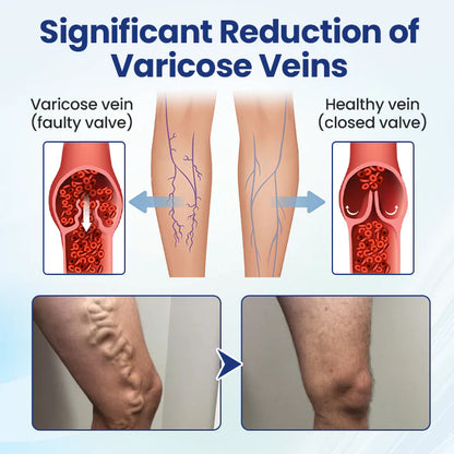Deep Vein Repair Microneedle Patch🔥🔥