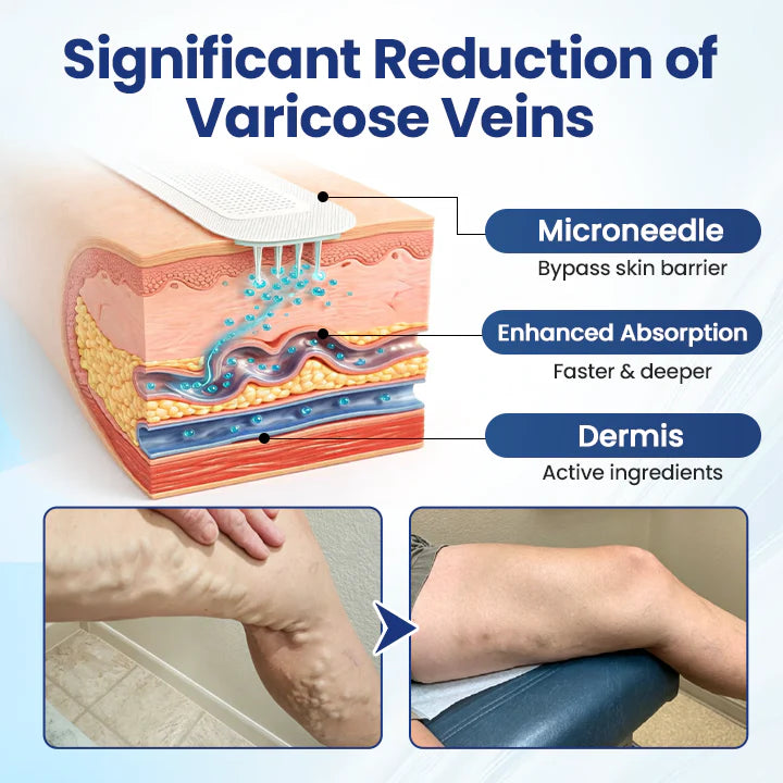 Deep Vein Repair Microneedle Patch🔥🔥
