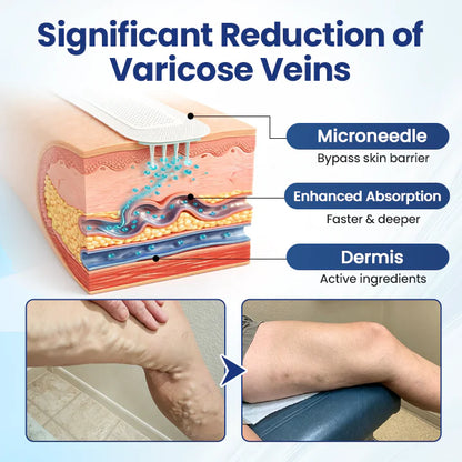 Deep Vein Repair Microneedle Patch🔥🔥